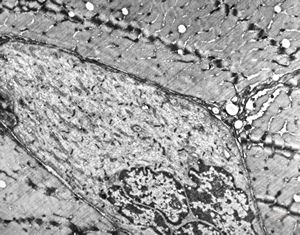 F,69y. | regenerating muscle cell F,69y. | regenerating muscle cell